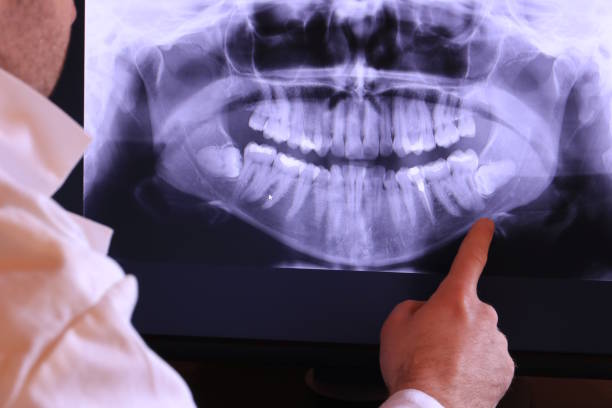 Best Emergency Dental Surgery in Valhalla, NY